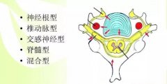 是什么伤害了你的颈椎？